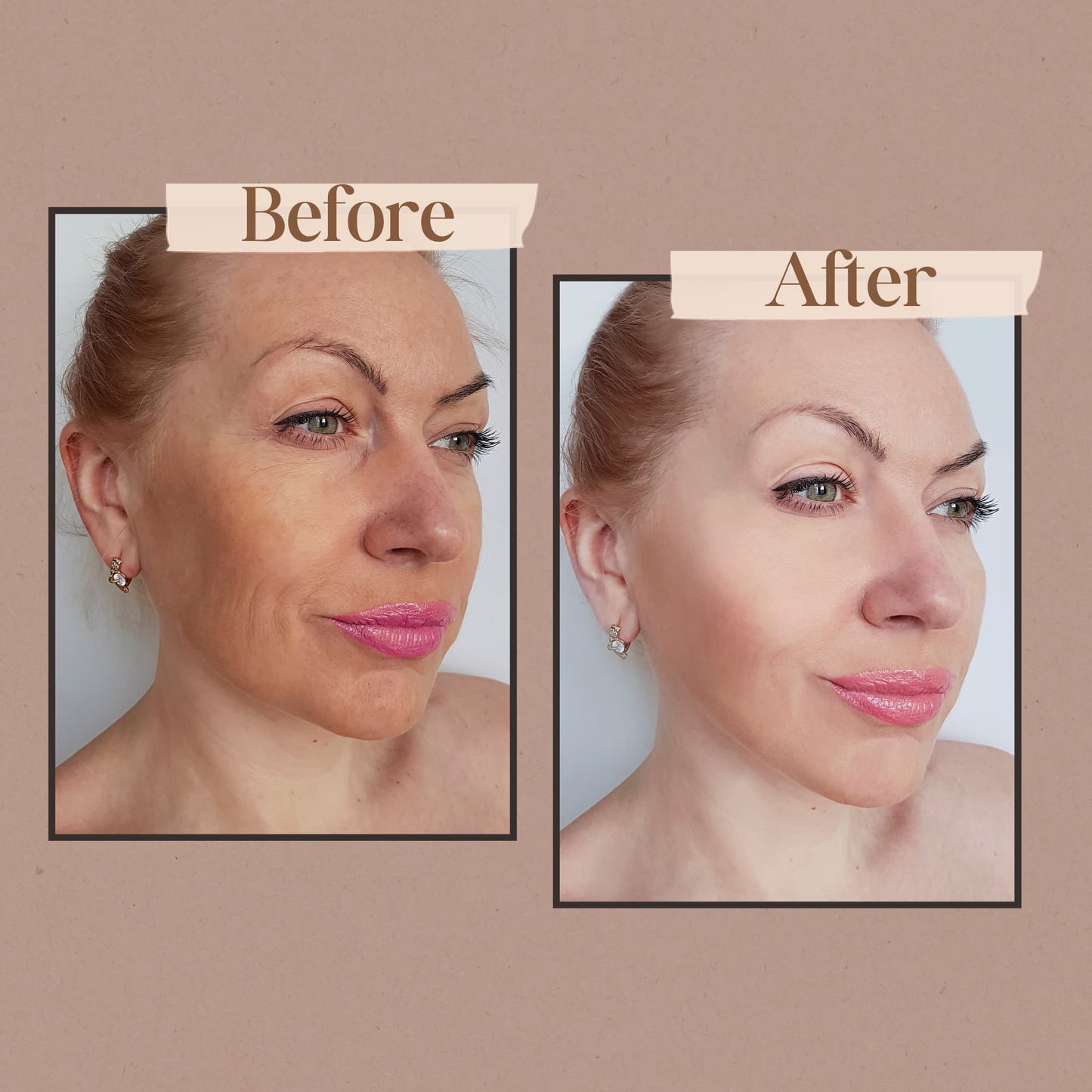 Masque VisioLume™ Pro 7 LED